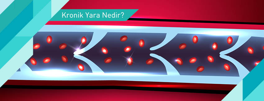 Kronik Yara Ne Zaman Doktora Gidilmeli? 10 Önemli İşaret